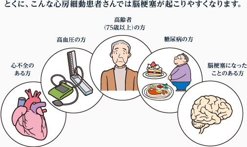 とくに、こんな心房細動患者さんでは脳梗塞が起こりやすくなります。 高齢者（75歳以上）の方、高血圧の方、糖尿病の方、心不全のある方、脳梗塞になったことのある方